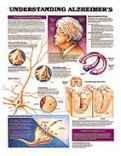 Understanding Alzheimer's