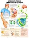 Understanding Parkinson's