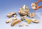 VH409 Brain Model