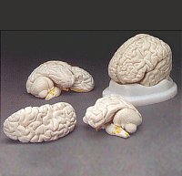 CH-1 Budget Brain Model
