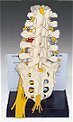 170 Lumbar Model